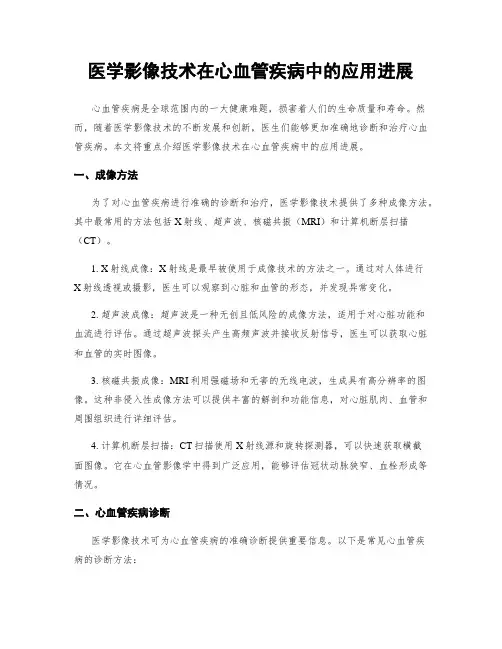 医学影像技术在心血管疾病中的应用进展
