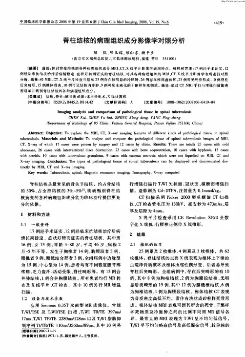 脊柱结核的病理组织成分影像学对照分析