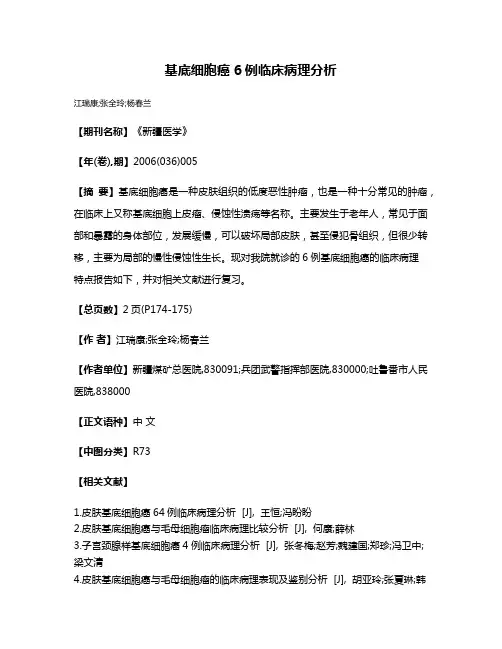 基底细胞癌6例临床病理分析