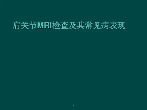 肩关节MRI检查及其常见病表现