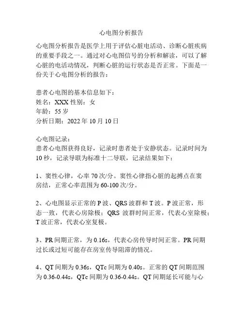 心电图分析报告