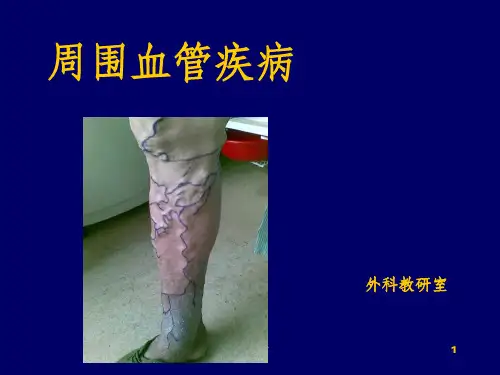 《周围血管疾病》PPT课件