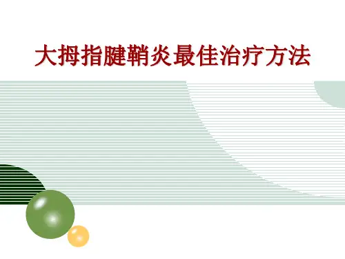 大拇指腱鞘炎最佳治疗方法