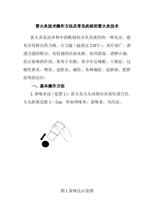 雷火灸技术操作方法及常见疾病的雷火灸技术