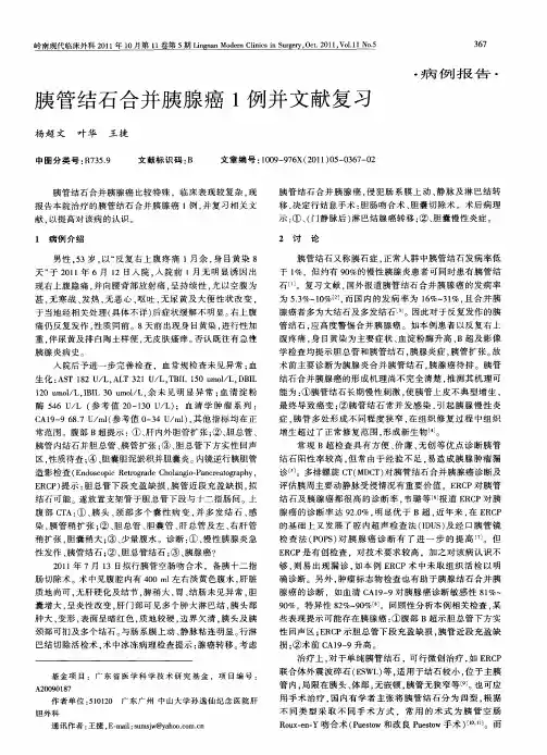 胰管结石合并胰腺癌1例并文献复习