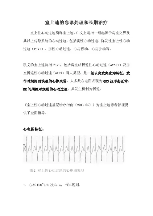 室上速的急诊处理和长期治疗