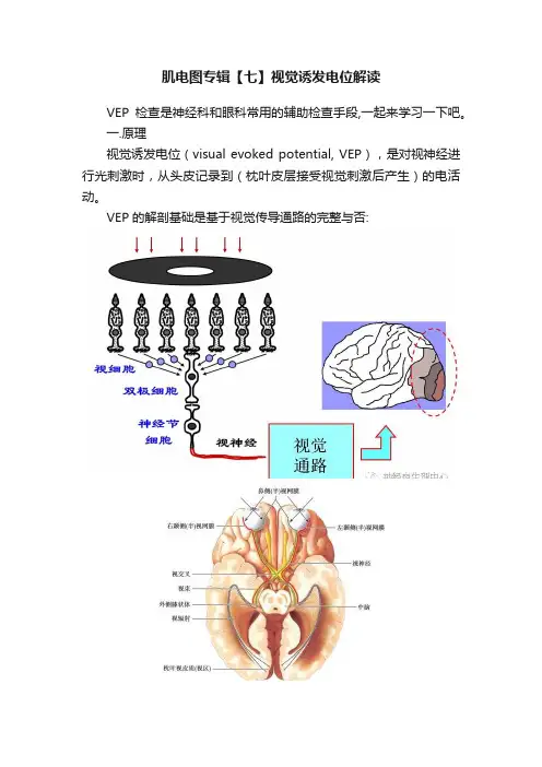肌电图专辑【七】视觉诱发电位解读
