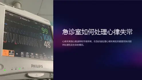 急诊室如何处理心律失常