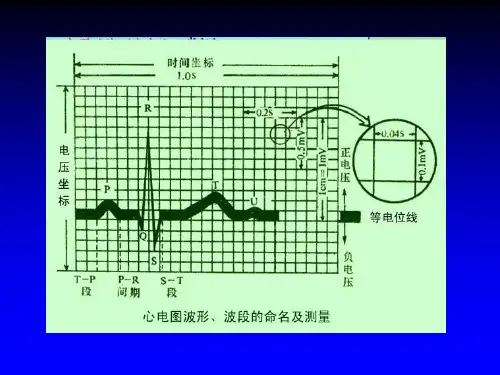 c1、正常心电图