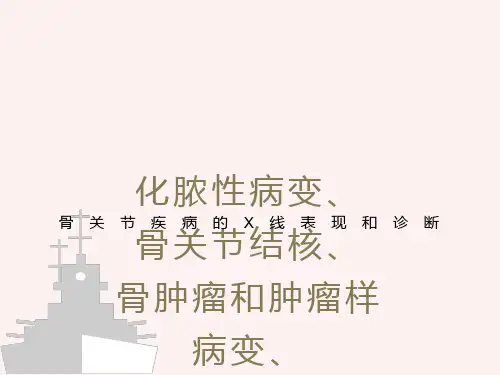 骨关节疾病的X线表现和诊断