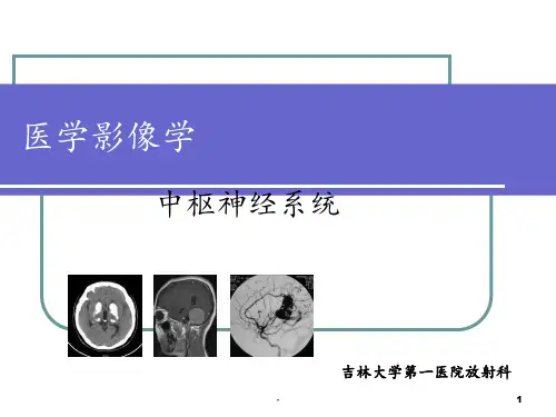 中枢神经系统PPT课件
