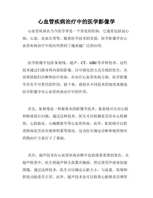 心血管疾病治疗中的医学影像学