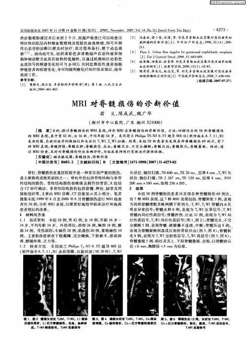 MRI对脊髓损伤的诊断价值