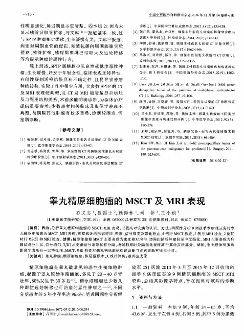 睾丸精原细胞瘤的MSCT及MRI表现