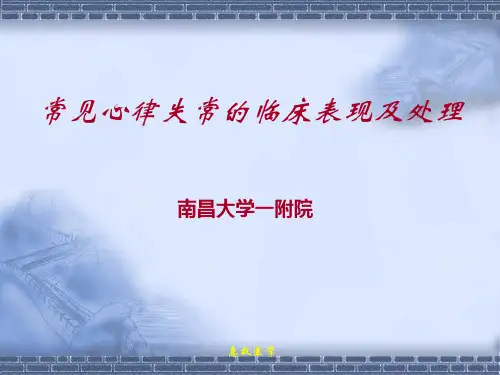 常见心律失常(有图)