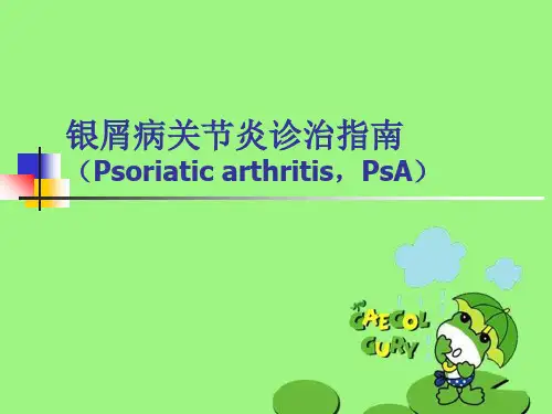 银屑病关节炎诊治指南(Psoriaticarthritis,PsA)