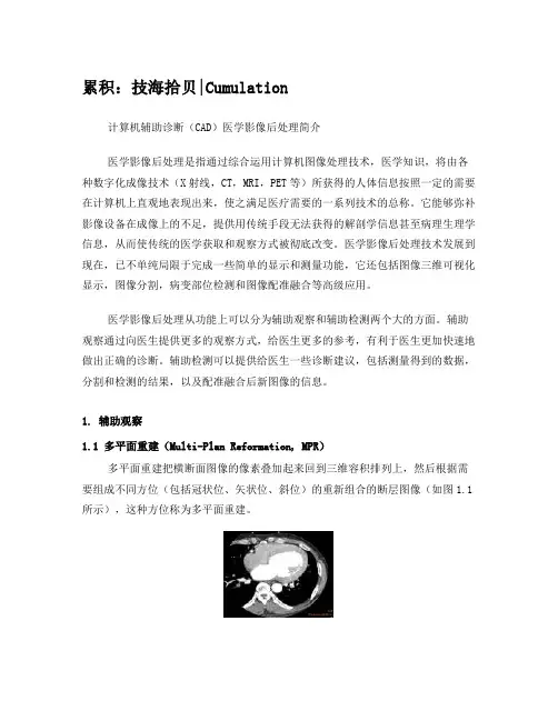 计算机辅助诊断(CAD)医学影像后处理简介