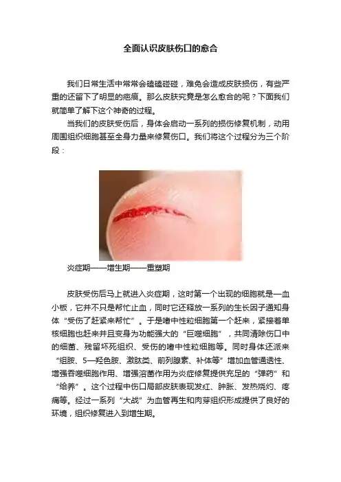 全面认识皮肤伤口的愈合