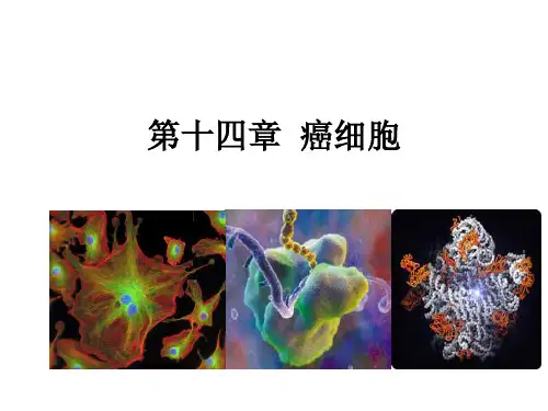 第14章 癌细胞
