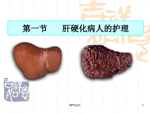 肝硬化病人低蛋白血症的护理  ppt课件