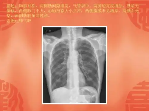 常见张X片读片及诊断