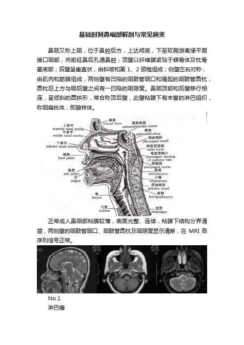 基础时刻鼻咽部解剖与常见病变