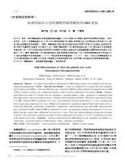 病毒性脑炎与急性播散性脑脊髓炎的MRI鉴别