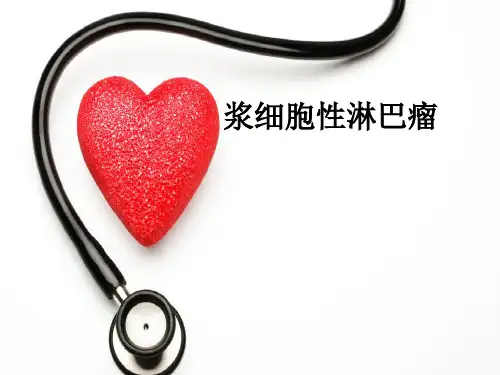 浆细胞淋巴瘤