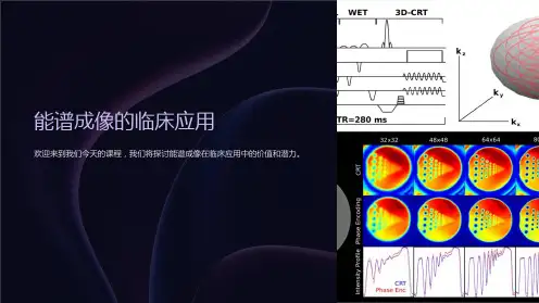 能谱成像的临床应用课件