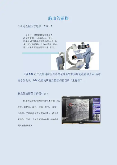 脑血管造影检查健康宣教