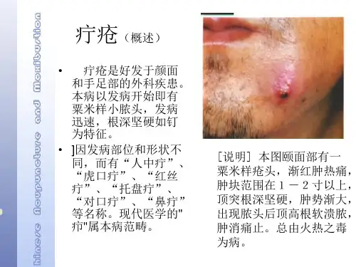 疔疮的针灸治疗