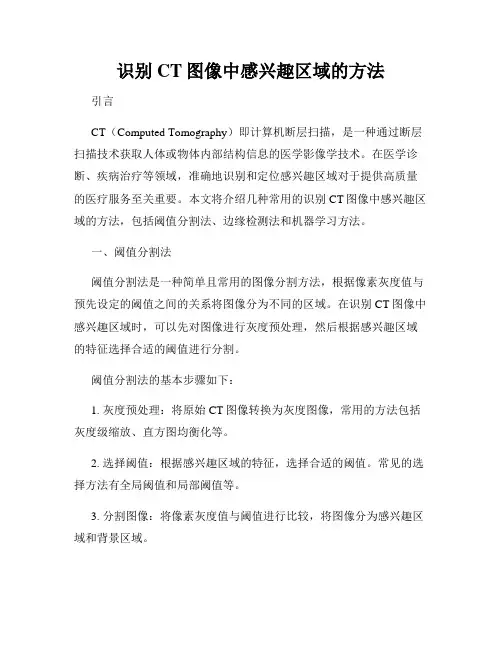 识别CT图像中感兴趣区域的方法