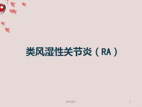 类风湿性关节炎 ppt课件