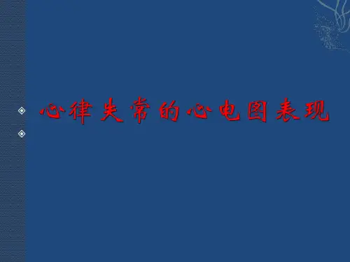心律失常的心电图表现