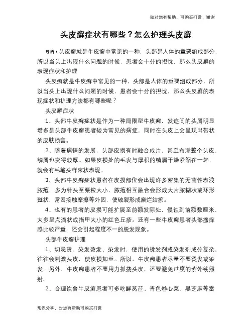 头皮癣症状有哪些？怎么护理头皮廯