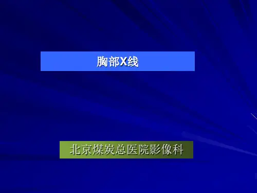 胸部 X线诊断ppt课件