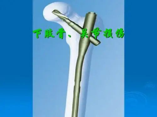 下肢骨、关节损伤讲义