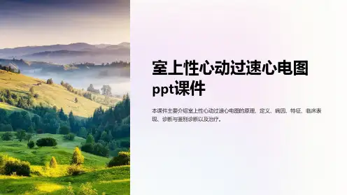 室上性心动过速心电图课件