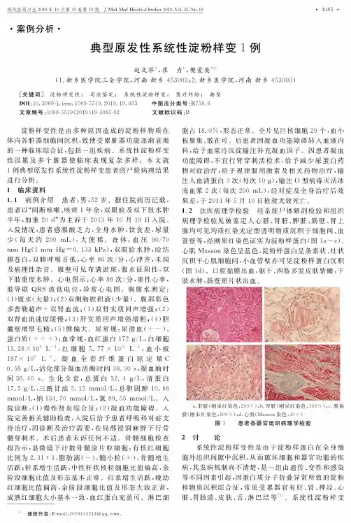 典型原发性系统性淀粉样变1例
