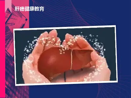 原发性肝癌健康宣教