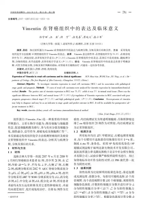 Vimentin在肾癌组织中的表达及临床意义