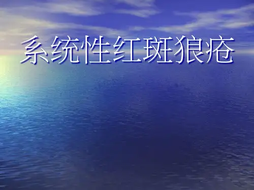 系统性红斑狼疮精品PPT课件