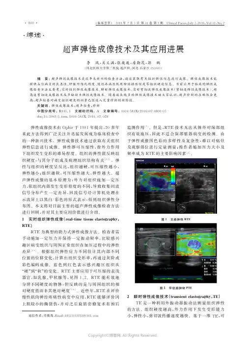 超声弹性成像技术及其应用进展