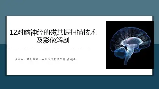 12对脑神经PPT
