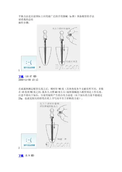 国际上最广泛的手用器械根管预备手法：平衡力法