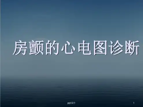 房颤的心电图诊断-2022年学习资料