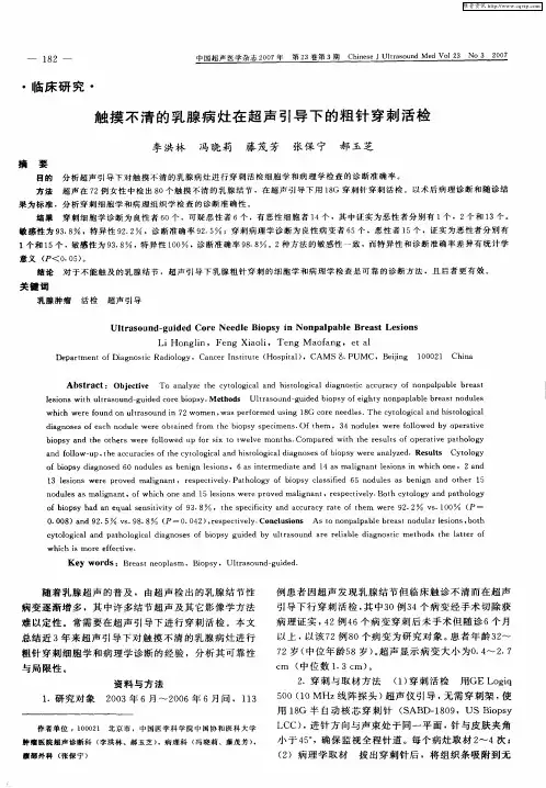 触摸不清的乳腺病灶在超声引导下的粗针穿刺活检