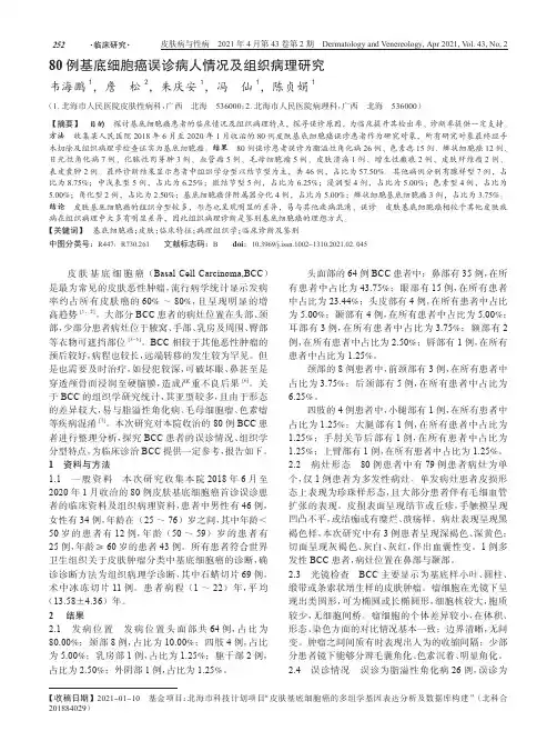 80例基底细胞癌误诊病人情况及组织病理研究