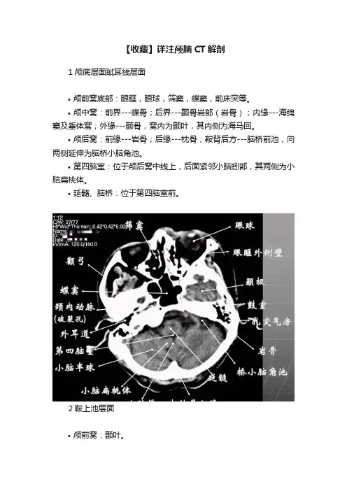 【收藏】详注颅脑CT解剖
