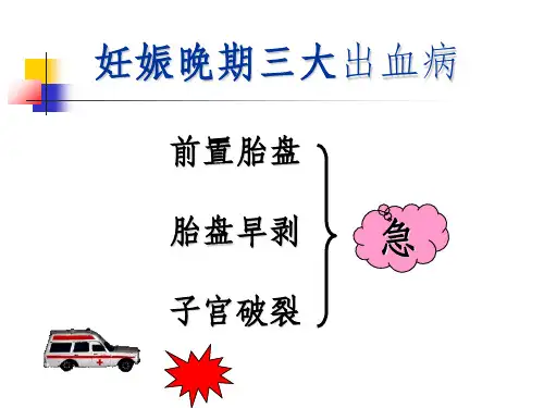 《前置胎盘》PPT课件